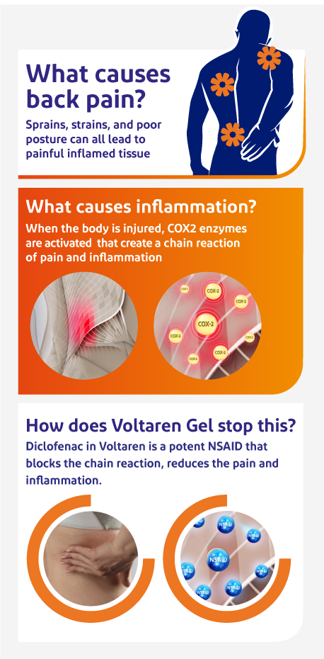 Infographic showing what causes back pain